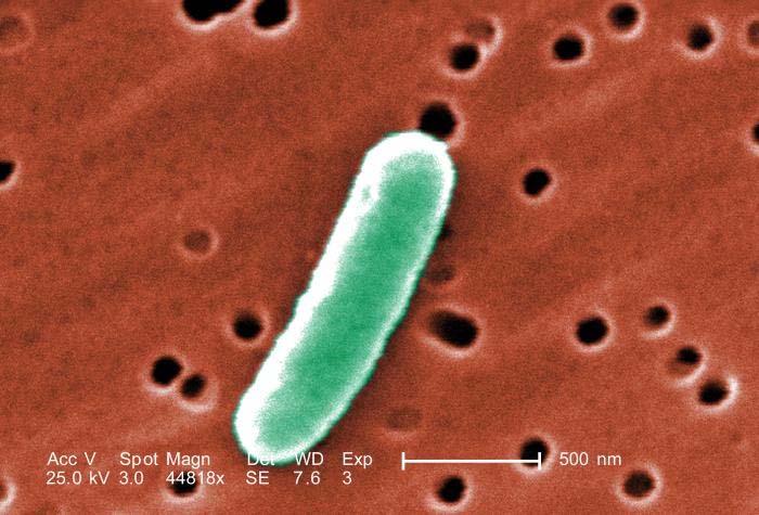 E. coli-enteritiden Escherichia coli, kurz E. coli genannt, zugehörig der Familie der Enterobacteriaceae, Gattung Escherichia, sind ubiquitär verbreitet.