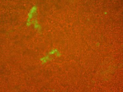 a b c Abbildung 17: Fluoreszenzmikroskopie von Zellen, die mit L1 RP transfiziert wurden.