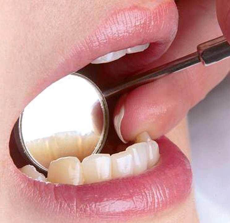 unten außen, rechts unten innen und wieder zurück. Zahnkaugummi: Zahnkaugummis bieten unterstützende Zahnpflege für zwischendurch. Die Kaugummis fördern den Speichelfluss.