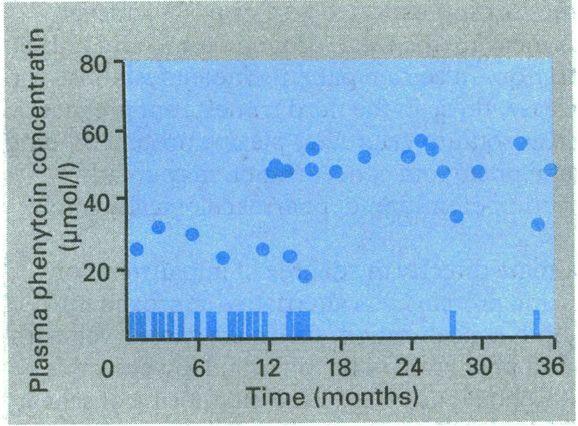 TDM von Phenytoin 8 Frühere Dosierungsfindung war geprägt durch trial and error Patienten mit derselben Dosis von Phenytoin können Blutspiegel besitzen, die sich um das 50-fache unterscheiden Gute