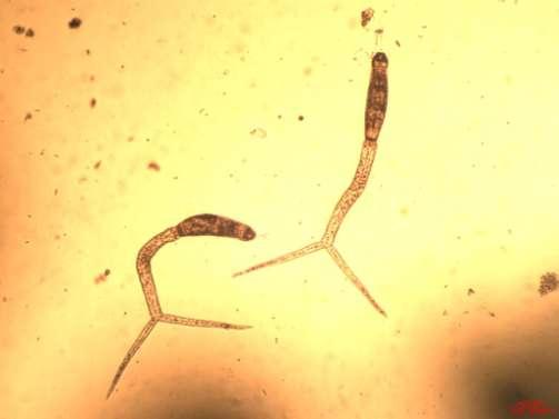 st free-living motile larval form Cercaria 2 nd free-living