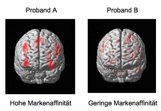 Neuromarketing in der Konsumforschung 23 Hirnregionen sichtbar gemacht werden und somit aufzeigen, in welcher Region der Markenstimulus zur Modulation des Blutflusses und somit zu erhöhten oder