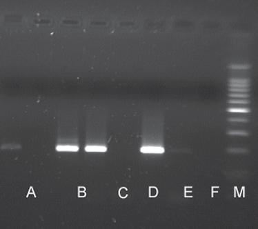 Abb. 1. Schema einer Real-time PCR-Reaktion (Taqman System).