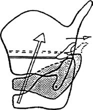 cricoarytaenoideus posterior (b) M.