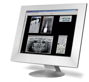 Digitale Röntgenbilder verbessern RVG-Digitalbilder bieten umfangreiche Informationen. Die Kodak Dental Bildverarbeitungssoftware ermöglicht eine ausführliche Analyse der Bilder.
