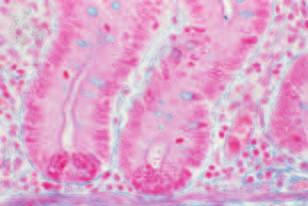 Zwischen den Enterozyten liegen vereinzelte Becherzellen (blau gefärbt). Dort ist der Bürstensaum unterbrochen. Enterozyten, Lamina propria, Darmlichtung. (Azan; Vergrößerung 00-fach.