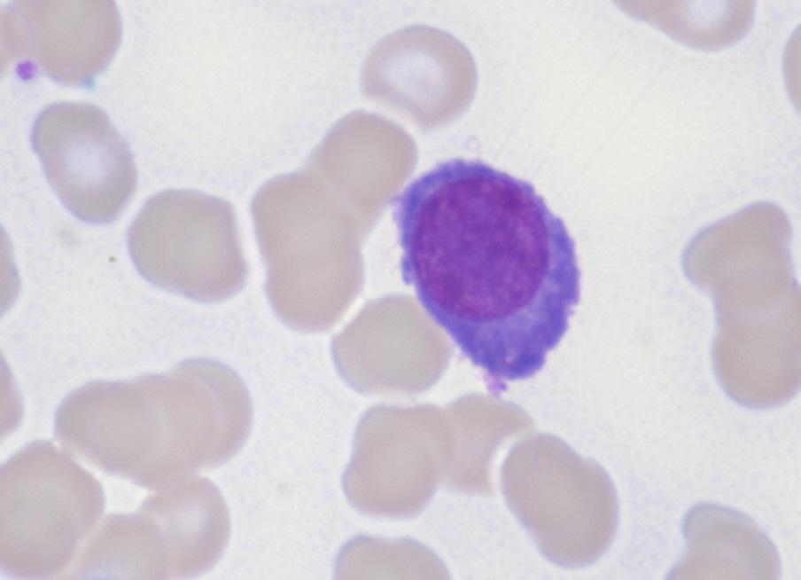 Plasmazellen (1) 1 1 3 2 Referenzinstitut