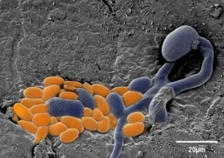 Botector (Wirk-Theorie) Mikroorganismen (orange) besiedeln die feinen Mikrorisse der Beerenhaut und bilden eine natürliche Konkurrenz um Platz und Nährstoffe zur Botrytis (blau).