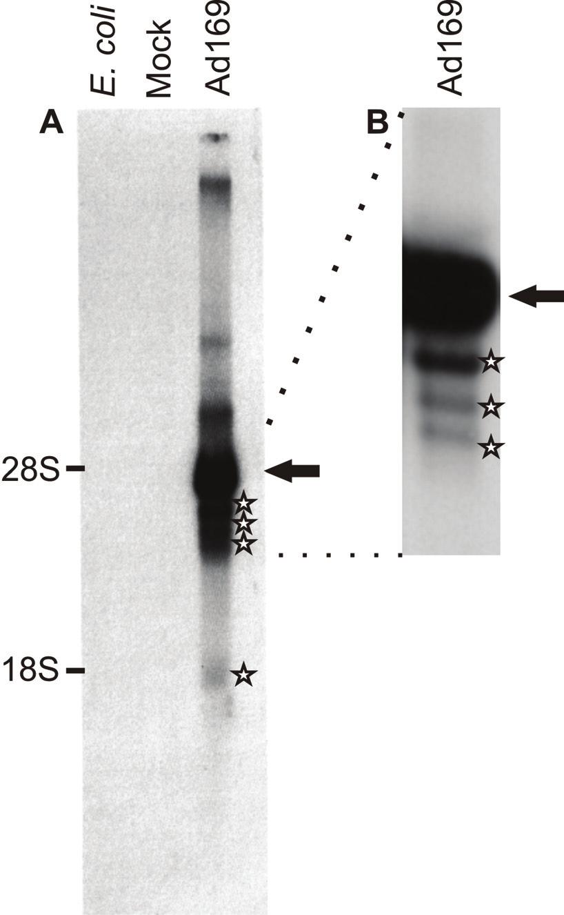 Ergebnisse Abb. 3.1: Nachweis neuer IE4-Transkripte im Northern Blot. Gesamt- RNA aus infizierten HFF (5 d p.i.) wurde 28 h in der denaturierenden Gelelektrophorese aufgetrennt und anschließend mit Sonde #5 hybridisiert.