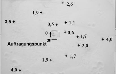 Ergebnisse 125 4.3.1.4 Bioautographie mit Striga hermonthica-samen 4.3.1.4.1 Test auf Verbreiterung Die Keimung von Striga hermonthica-samen war nur in einer feuchten Umgebung möglich, wie die Petrischalenkeimungstests zeigten.