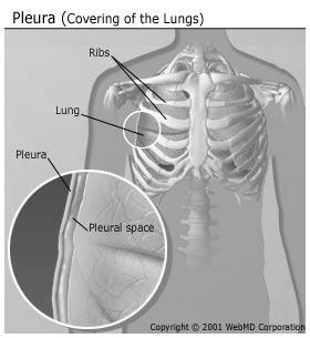 Pleura Pleura bedeckt die Lunge Pleuraspalt: Vakuum