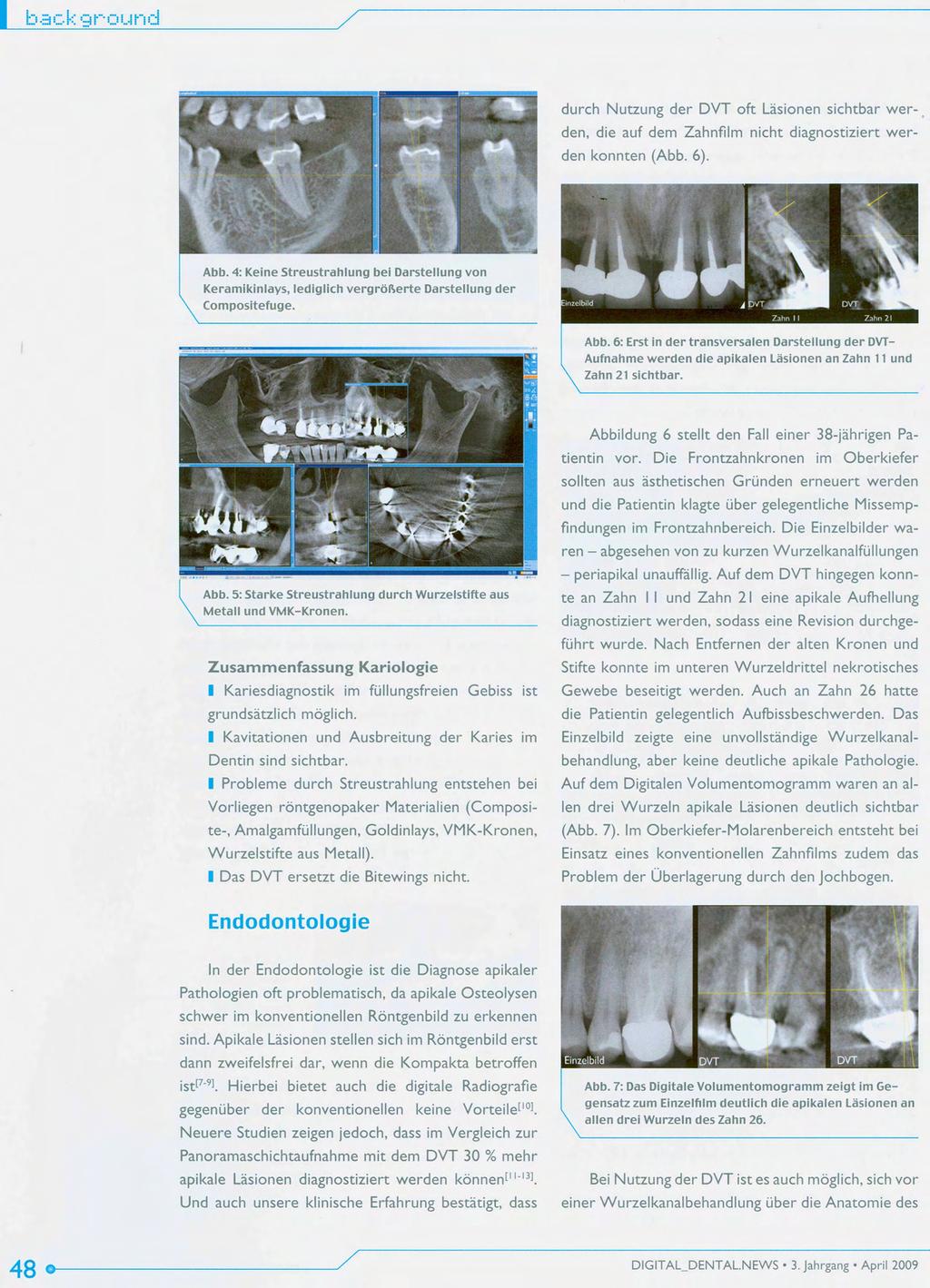 durch Nutzung der DVT oft Lasionen sichtbar wer-, den, die auf dem Zahnfilm nicht diagnostiziert werden konnten (Abb. 6). Abb.