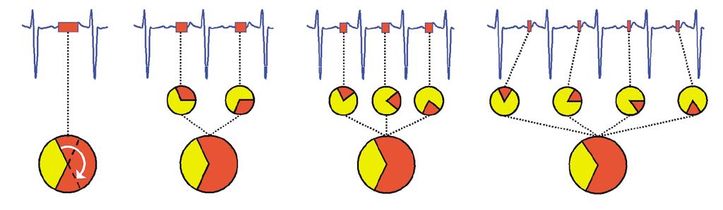 Auflösung 185 ms FOV: 180 mm, Matrix: 512 x 512 CT Geschichte und Grundlagen der CT Herausforderungen beim Kardio-CT Retrospektives EKG-Gating Prospektives EKG-Gating Flash-CT Röhre: z-springfocus