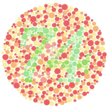 Störungen des Farbensehens Ca. 8% aller Männer haben Störungen des Rot-Grün-Sehens, was auf eine Fehlfunktion von Zapfen zurückzuführen ist.