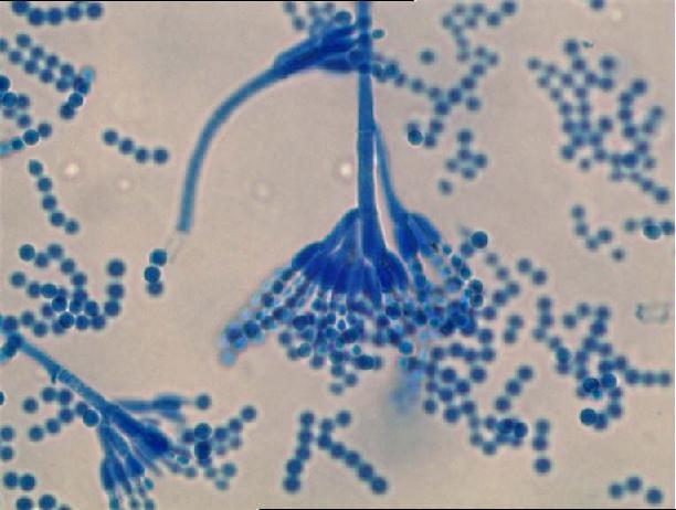 Analysen im Labor Mikroskopische Pilzbestimmung Vergleich der Innenluftkeime mit den Außenluftkeimen Penizillium