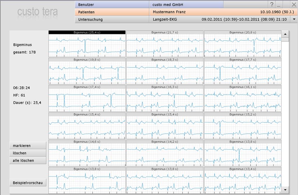 06.3.5 Beispiele, alle anzeigen (Schaltfläche alle anzeigen in der Beispielvorschau) Alle EKG-Beispiele eines Ereignisses Zusatzinformationen zum ausgewählten EKG-Abschnitt Markieren des ausgewählten