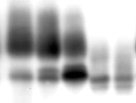 Ergebnisse IRKD hirs-1 p30 1 2 3 4 5 Abb. 7.19: Zeitverlauf der transienten Phosphorylierung des vorphosphorylierten hirs-1 p30.