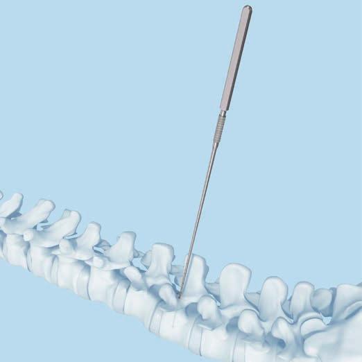 Pedikelschraube einbringen Die Länge der Pedikelschraube mit dem Tiefenmessgerät