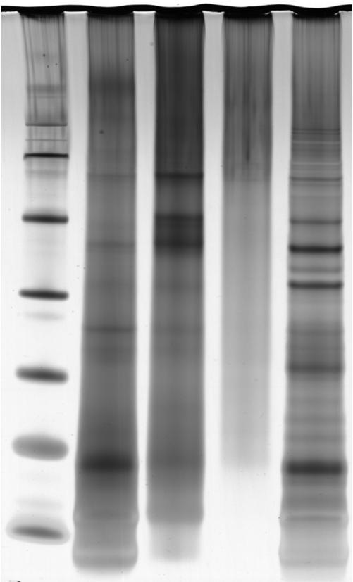 Hautprick-Testextrakte - Qualitätskontrolle SPT-Lösungen Roggenmehl: Protein- und Antigenanteil, SDS-Page Hersteller Protein [µg/ml] Antigen [U/ml] % positive SPT* 1 Test- Effizienz [%]* 2 A Bencard