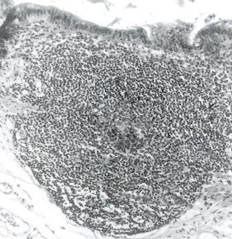 Peyersches Plaque M-Zellen Keimzentrum (Aktivierung