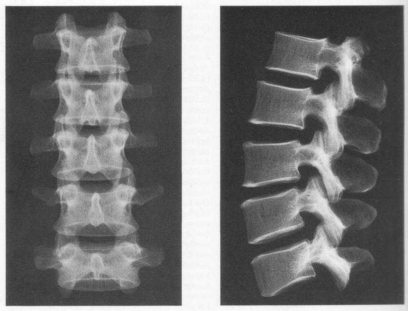 2. Grundlagen 2.1 Anatomie der Lendenwirbelsäule (14, 45, 121, 137) Die Wirbelsäule, Columna vertebralis, stellt das bewegliche Achsenskelett des menschlichen Körpers dar.