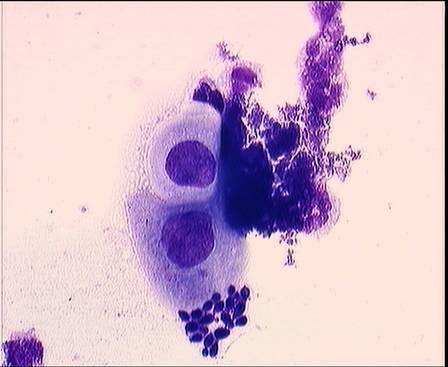 Cytologische Kriterien -