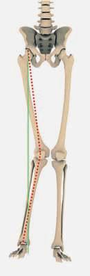 Das Knie Das kranke Knie Ursachen und Symptome Gelenkbeschwerden zählen zu den großen Volkskrankheiten. Bei 20 40% der 60 Jährigen fi nden sich in Röntgenuntersuchungen Zeichen für eine Arthrose.