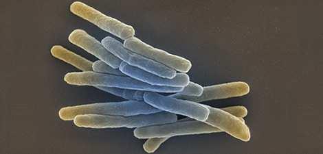 Teil 1 Mikrobiologische Diagnostik der Tuberkulose