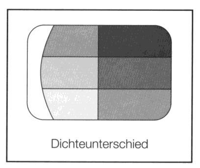 Das Prüfkörperbild zeigt entsprechend den Aufnahmen der Konstanzprüfung der Filmverarbeitung ein Streifenbild mit drei (bei einigen Prüfkörpern fünf) Graukeilen (Abb. 4).
