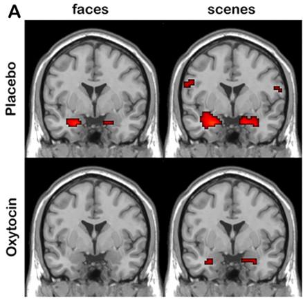 fmri-studien zum Effekt von Oxytocin Oxytocin wirkt modulierend auf die Amygdala, wenn Probanden angsterregende Gesichter und Szenen betrachten (Kirsch et al., 2005).