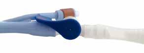 CARE VENT CAREFLOW Katheterventil zur individuellen selbstständigen Harnblasenentleerung 8 Optimale Lösung für den mobilen und selbstständigen Anwender, der erstmalig für einen begrenzten Zeitraum