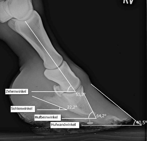 Erfassung der Hufbeinrotation a) zur Hornkapsel HBW - HWW