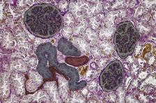 332 10 Die Funktion der Nieren peritubuläre Kapillaren Bowman- Kapsel-Raum größeres Blutgefäß proximaler Tubulus (Pars convoluta) Glomeruli gen.
