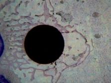 29) mit Fettzellen, abschnittsweise auch Vorstufen der Hämopoese oder einige wenige Makrophagen zu beobachten.