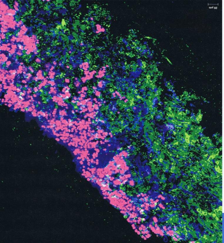 Definition Biofilme Biofilme sind Ansammlungen von Mikroorganismen, die feste Oberflächen in wässriger oder