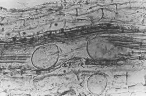 Die Ergebnisse zeigten, dass nicht nur die Besiedlung der Faserwurzeln durch die AM sehr zeitig beginnt, sondern dass auch die Anlage der Vesikel in noch ganz jungen Wurzelpartien erfolgt.