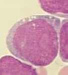 und nur zwei Kernsegmente beineutrophilengranulozyten, sehr kleineeinzelkernebei Megakaryozyten und