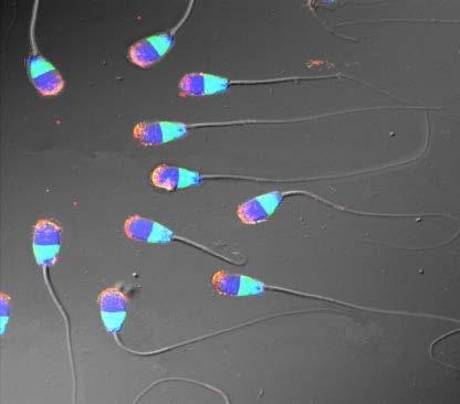 Pheromone bei der Befruchtung menschlicher Eizellen Auch Spermien reagieren mit Ca 2+ Einstrom