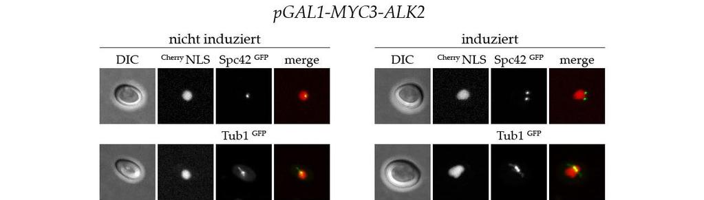 Ergebnisse ALK2 führte zu einem erhöhten Anteil an knospenlosen Zellen, die duplizierte Spindelpole mit einer kurzen, bipolaren Spindel aufwiesen.