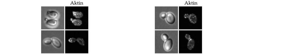 Die Verteilung des Fimbrins Sac6 zeigte, dass die Polarisation des Aktin-Zytoskeletts verfrüht aufgehoben wurde, da bei vielen Zellen mit vergleichsweise kleiner Knospe die Aktin-Patches bereits