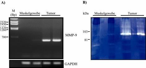 Abb. 7: 3LL-Tumormaterial zeigt gelatinolytische Aktivität (A) Aus jeweils zwei verschiedenen Muskelgeweben und 3LL-Tumoren wurde Gesamt-RNA präpariert und in einer RT-PCR-Analyse auf Anwesenheit