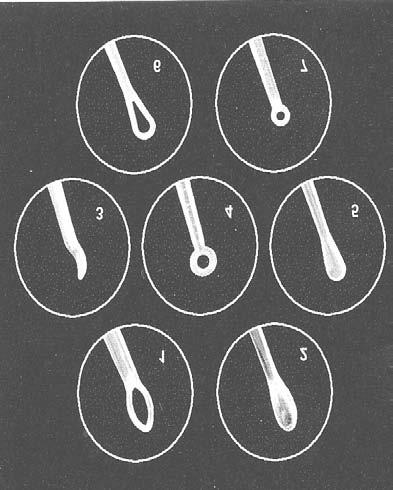 Das flexibele Material (Polypropylen) passt sich an und schützt den empfindlichen Ohrenkanal und das Trommelfell.