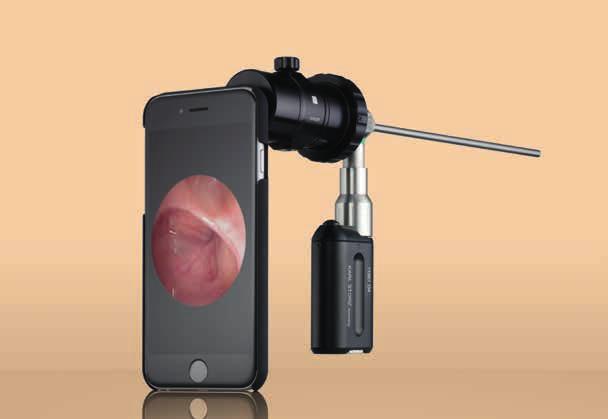 SMART SCOPE Der Endoskop-Adapter für Smartphones In Kombination mit KARL STORZ Endoskopen ermöglicht der Smartphone-Adapter von KARL STORZ eine einfache Dokumentation des endoskopischen Bildes auf