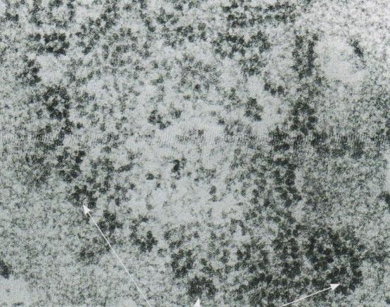 Mitochondrium, Peroxysoma 40S