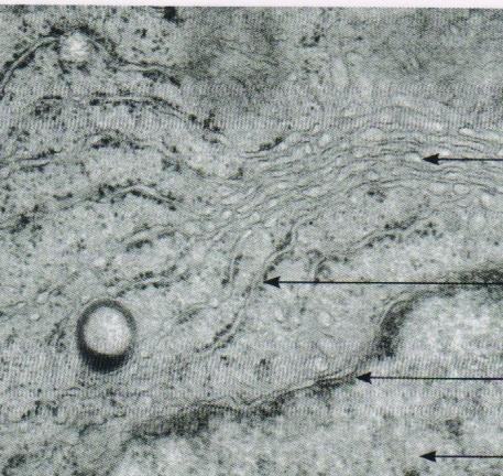 Glattes endoplasmatisches Retikulum Tubuli, Bläschen oder Zisternenstapeln (Lamellae annulatae in