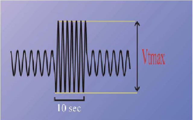 D. Spirometrie / Ergospirometrie LUNGE 3 1. Spirometrie Die kleinsten messbaren Volumenanteile werden als Volumina bezeichnet.
