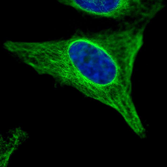 Ergebnisse Abb.13: Die Behandlung von HeLa-Zellen mit shrnas gegen Aurora-C führt zum Verlust des cytoplasmatischen Raums.