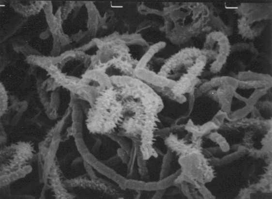 morphology and spore surface in SEM E and F x 5.000 Copyright: PD Dr. Joachim M.
