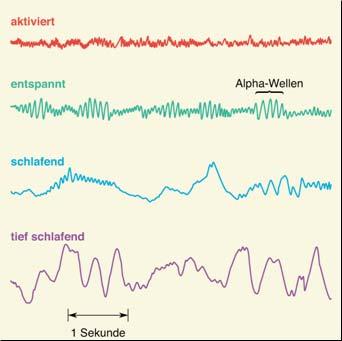 Methoden zur Untersuchung des NS 6) Elektroenzephalographie (EEG) Die EEG zeichnet elektrische Spannungsschwankungen (mv) auf, die im Zuge neuronaler Aktivität entstehen.