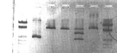 4. Resultate: A. Grössenbestimmung der subklonierten PCR-Produkte Die subklonierten PCR-Produkte wurden in E.